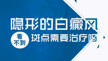 诊断治疗-白癜风治疗好要注意什么呢